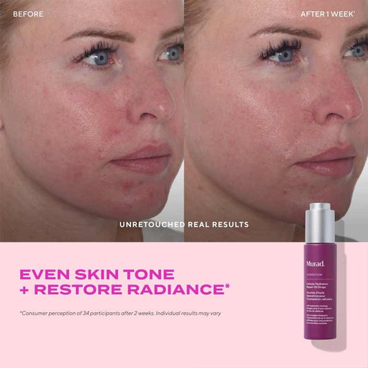 Murad Cellular Hydration Repair Oil Drops Before & After