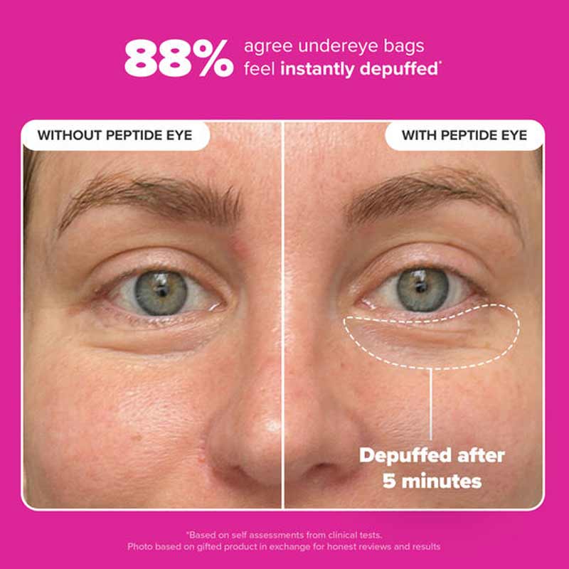Paula's Choice Pro-Collagen Peptide Firming Eye Serum Results On Real Eye