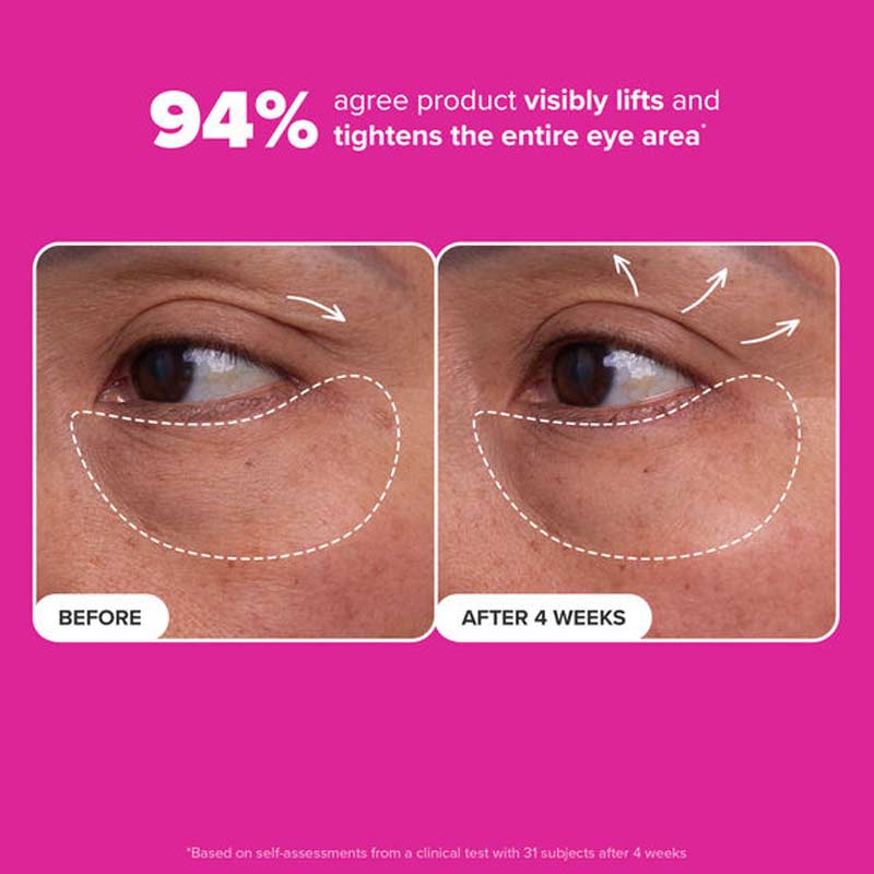 Paula's Choice Pro-Collagen Peptide Firming Eye Serum Undereye Results