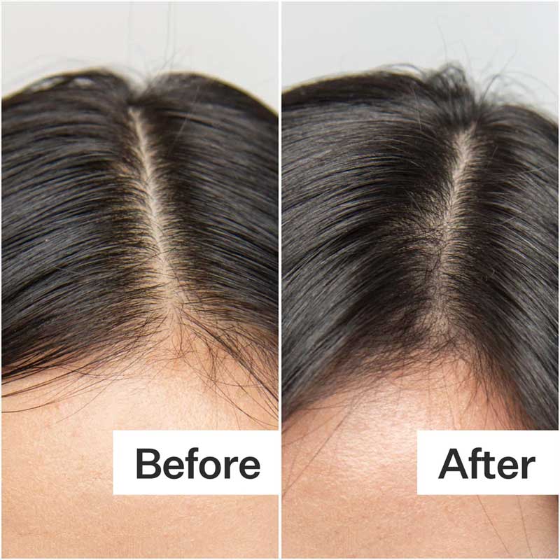 Act+Acre Oily Hair System | Hair Cleanse + Hair Conditioner | Healthy scalp | Healthy hair