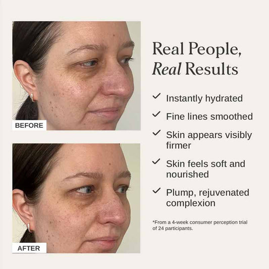 Alpha-H Firming Collagen Repair Cream Before & After