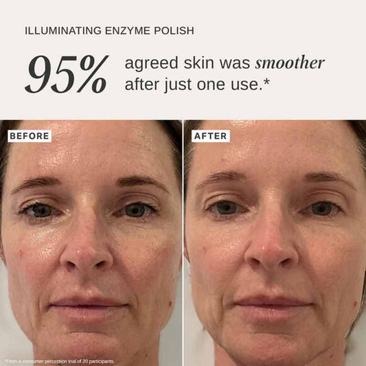 Alpha-H Illuminating Enzyme Polish with Native Rosella Flower Before & After