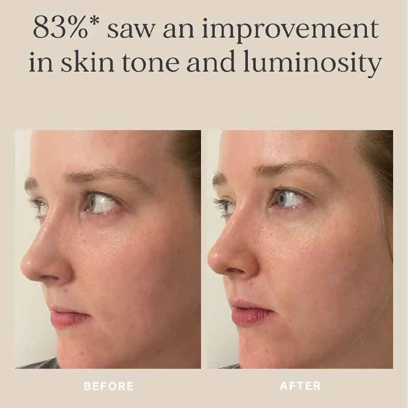 Alpha-H Midnight Reboot Serum, dull skin tone, skin brightening serum