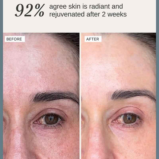 Alpha-H Multi-Peptide Revitalise Serum Before & After