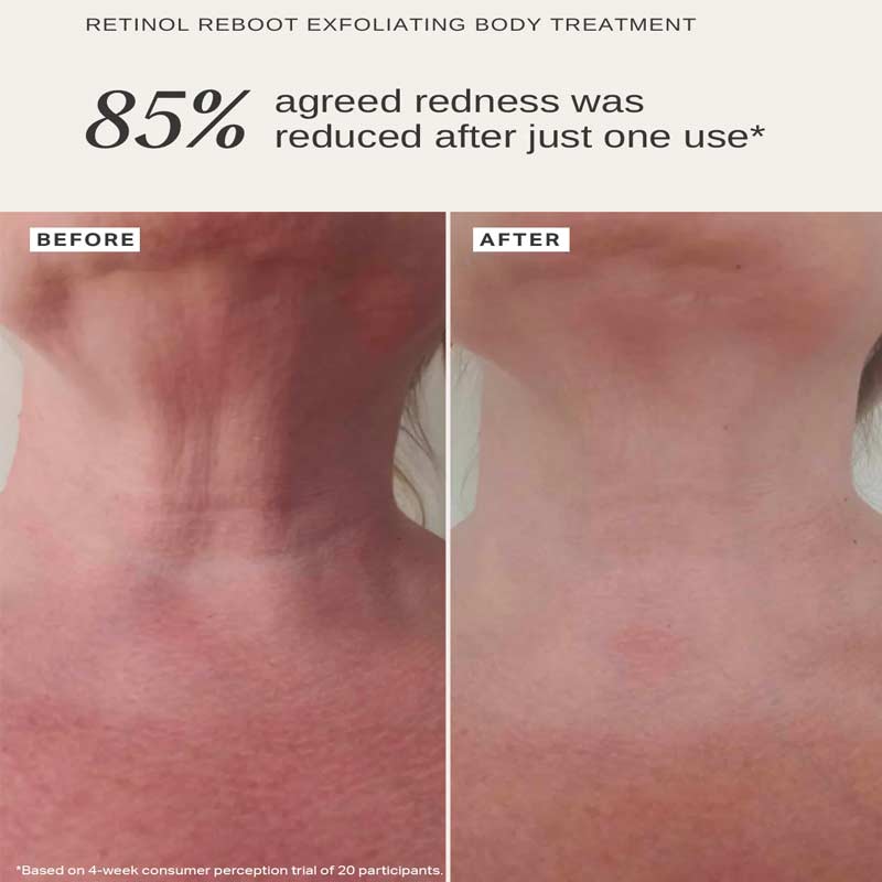 Alpha-H, Retinol Reboot Exfoliating Body Treatment, Reduce redness, skin redness, anti-ageing bodycare