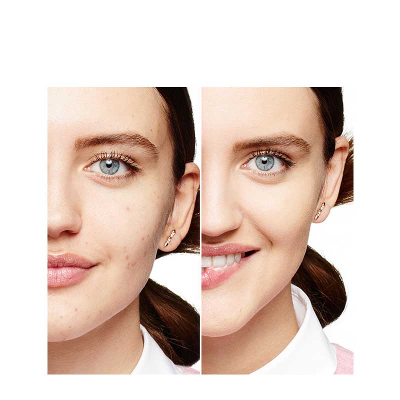 Benefit Boi-ing Industrial Strength Concealer | Full Coverage | Matte finish | Before and After