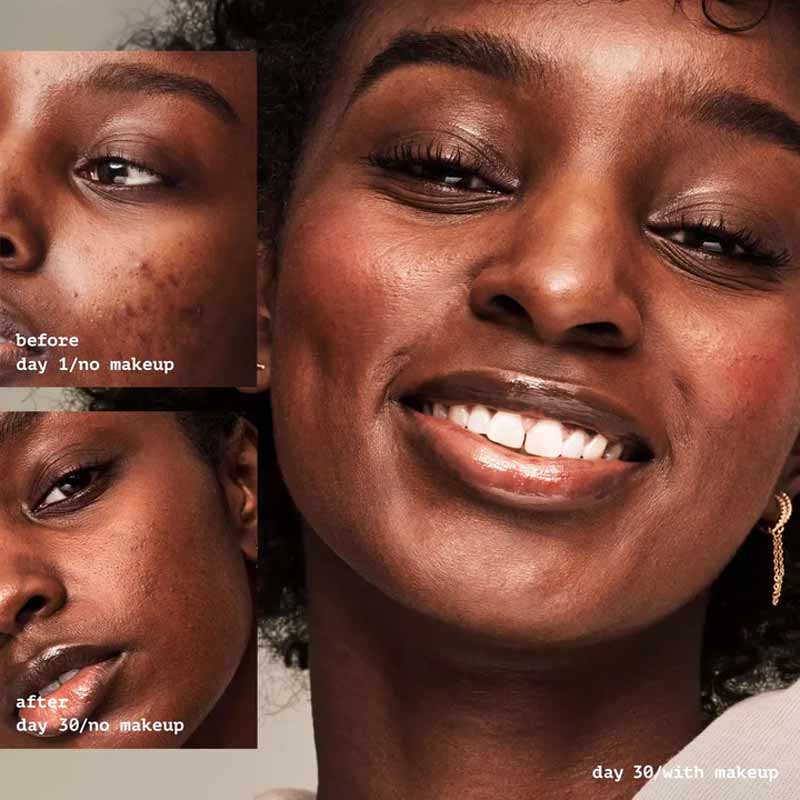 e.l.f. | Blemish Fighting | Putty Primer | hard working | primer | perfect base | makeup | prevent acne | reduce | appearance | blemishes | skin-centric ingredients | 1.8% Salicylic Acid | Zinc | Kaolin | balance | skincare | makeup