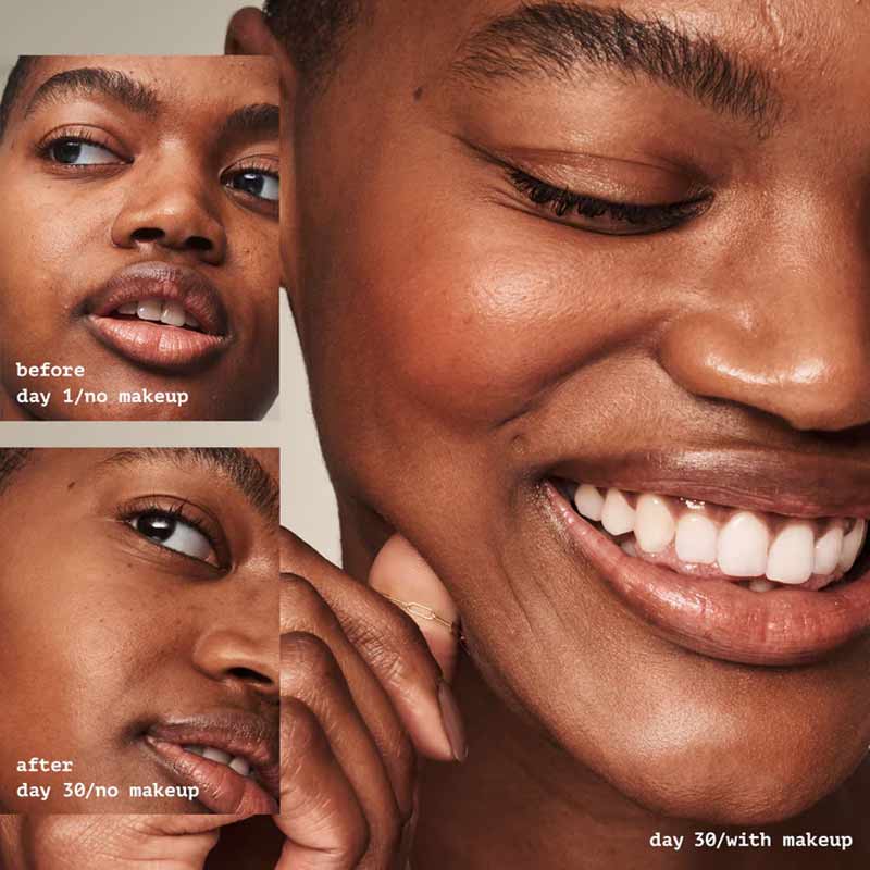 e.l.f. | Blemish Fighting | Putty Primer | hard working | primer | perfect base | makeup | prevent acne | reduce | appearance | blemishes | skin-centric ingredients | 1.8% Salicylic Acid | Zinc | Kaolin | balance | skincare | makeup