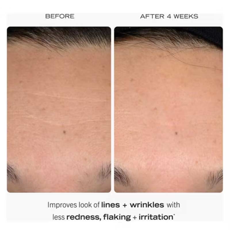 First Aid Beauty | 0.3% Retinol Complex Serum | Peptides | retinol serum | sensitive skin | improves lines and wrinkles | less irritation | skin-transforming serum | Retinol | Retinyl Propionate | optimised dosage | 24-hour hydration | amazing results | Peptides strengthen barrier | deep absorption | aids skin cell turnover | smoother skin | firmer skin | youthful look
