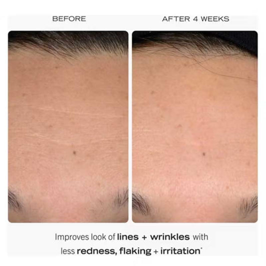 First Aid Beauty | 0.3% Retinol Complex Serum | Peptides | retinol serum | sensitive skin | improves lines and wrinkles | less irritation | skin-transforming serum | Retinol | Retinyl Propionate | optimised dosage | 24-hour hydration | amazing results | Peptides strengthen barrier | deep absorption | aids skin cell turnover | smoother skin | firmer skin | youthful look