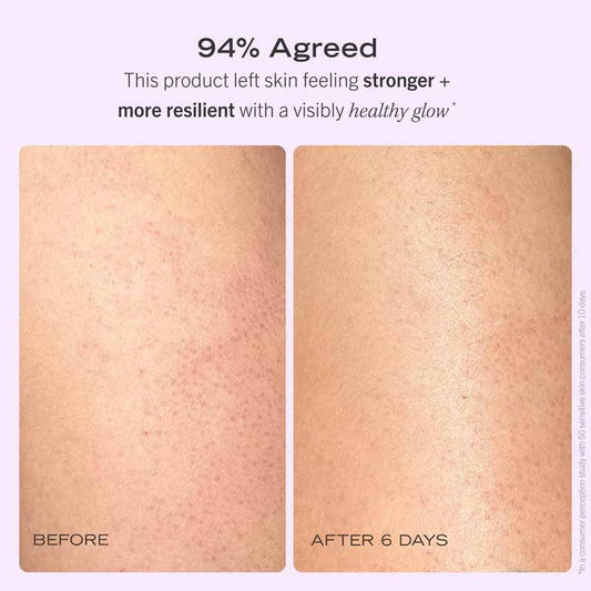 First Aid Beauty After Shower Nourishing Body Oil Before & After