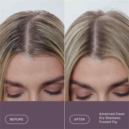 Before-and-after split comparison of a woman's hairline and part line, showing a clearer, healthier-looking hair transition with blonde highlights. The bottom features a dark purple banner with the text 'BEFORE', 'AFTER', and 'Advanced Clean Dry Shampoo Frosted Fig'.