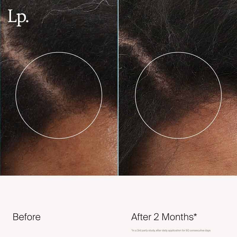 Living Proof Scalp Care Revitalizing Treatment | night-time treatment | ally | environmental stressors | hair grows fuller | thicker | healthier | root | damaged strands | vibrant hair.