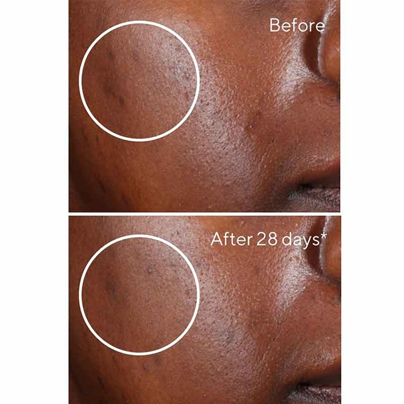 Murad | Rapid | Dark Spot | Correcting Serum | glycolic acid | face serum | removes dead skin cells | promotes cell turnover | brighter | even | complexion | natural radiance | penetration