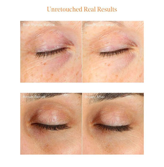 Murad Environmental Shield Vita-C Eyes Dark Circle Corrector | Treatment for Undereye Circles