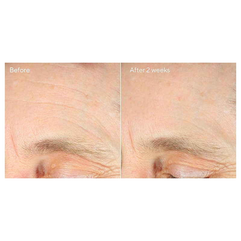Murad Intense Recovery Cream | before and after
