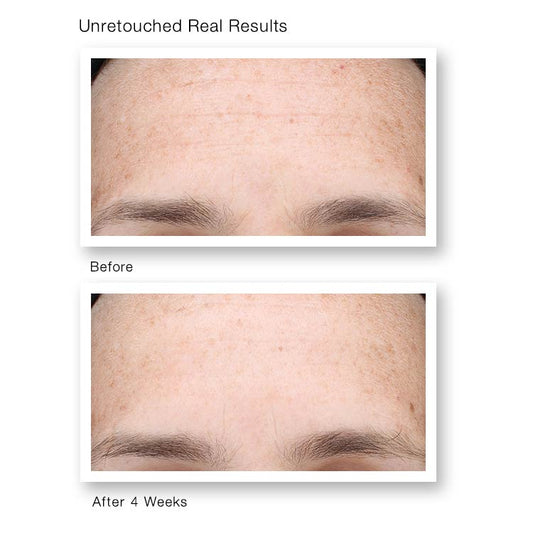 Murad Multi-Vitamin Infusion Oil | before and after | results | Vitamin C oil | anti aging oil | dark spots