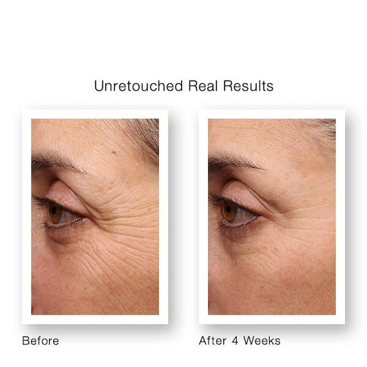 Murad Resurgence Retinol Youth Renewal Eye Serum Before & After | anti wrinkle