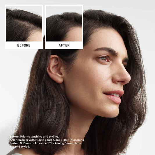 Nioxin system 3 Three Part Loyalty Kit, Shampoo conditioner and treatment for scalp and hair, thinning hair