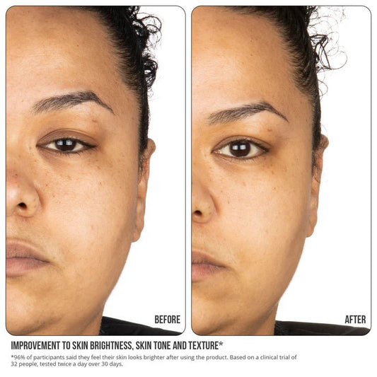 Nip & fab, dull skin