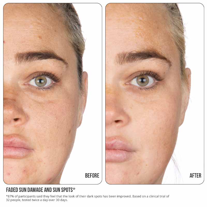 Nip + Fab Vitamin C Fix Concentrate Extreme 15%