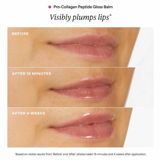 Promotional graphic for Pro-Collagen Peptide Gloss Balm showing close-up before/after results on lips. The top panel is labeled BEFORE, the middle panel AFTER 15 MINUTES, and the bottom panel AFTER 4 WEEKS, all on a white background with product text at the top.