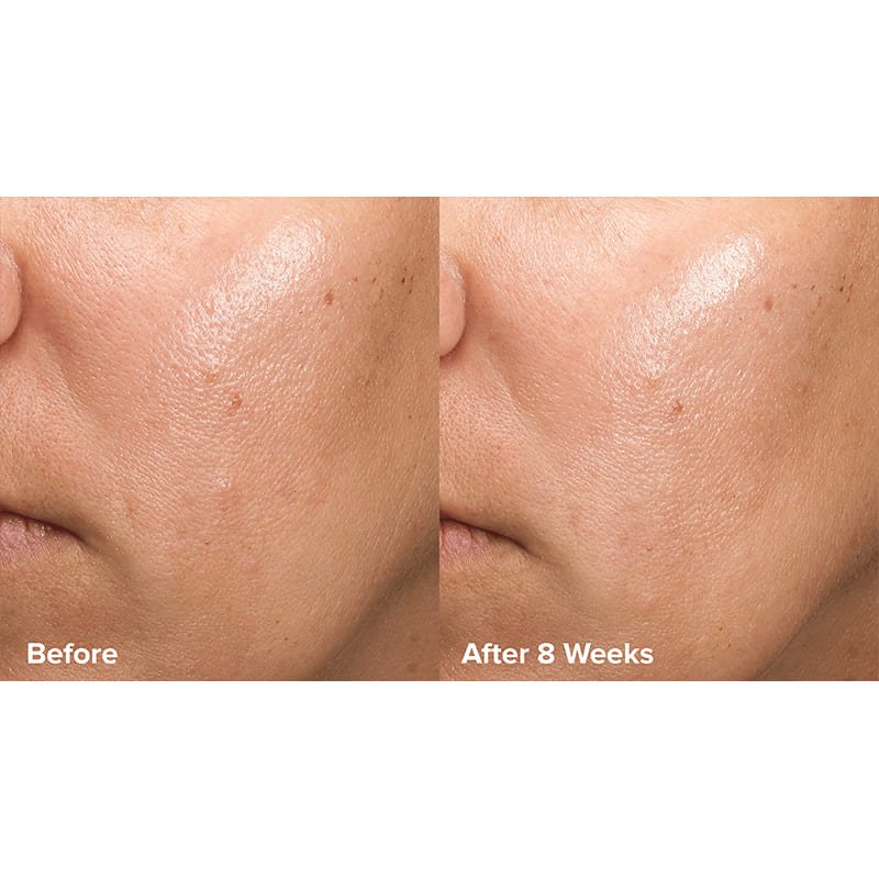 Paula's Choice Skin Perfecting 6% Mandelic Acid + 2% Lactic Acid Liquid Exfoliant | Crafted by #1 Exfoliation Experts | Innovative Formula | 6% Mandelic Acid, 2% Lactic Acid | Gentle yet Effective Exfoliation | Time-Released 8% AHA Multi-Layer Complex | Improves Radiance, Softens Texture | Promotes Healthier Skin Turnover | Youthful Glow