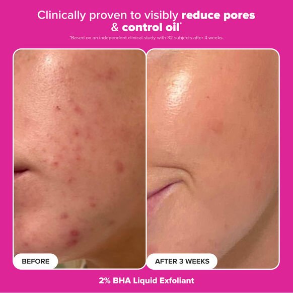 Paula's Choice, Paula's Choice The Plump & Glow Kit