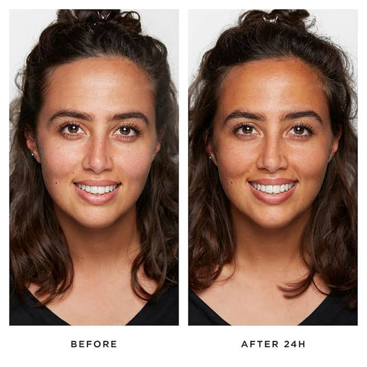 Pestle & Mortar Glow Drops | before and after