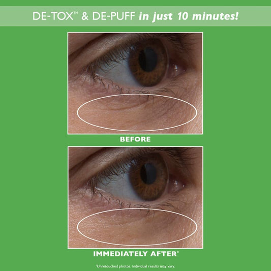 Peter Thomas Roth, Peter Thomas Roth Cucumber De-Tox Hydra-Gel Eye Patches before and after