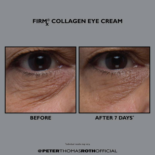 Peter Thomas Roth, Peter Thomas Roth FIRMx Collagen Eye Cream, Fine Lines Under Eyes