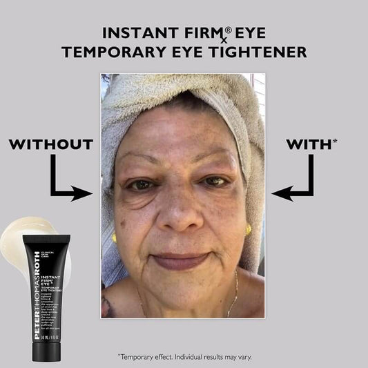 Peter Thomas Roth, Peter Thomas Roth FIRMx DUO, reduce fine lines, target wrinkles