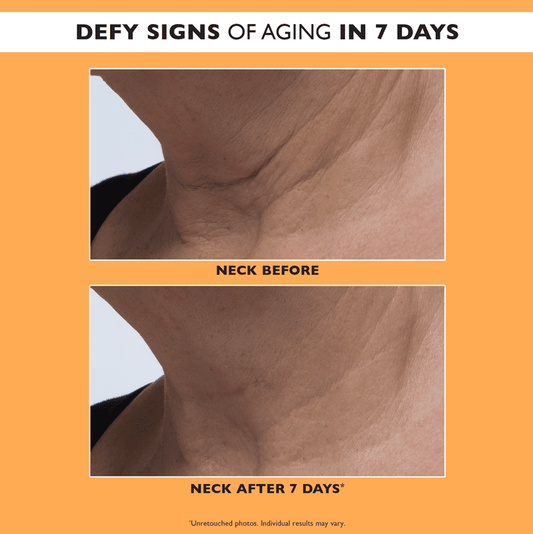 Peter Thomas Roth, Peter Thomas Roth Potent-C Power Serum, Vitamin E Serum