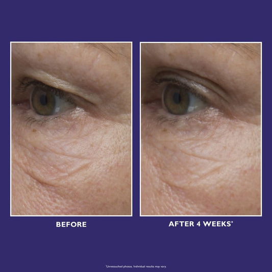 Peter Thomas Roth, Peter Thomas Roth Ultimate Solution 5 Multitasking Eye Cream, For Fine Lines And Wrinkles