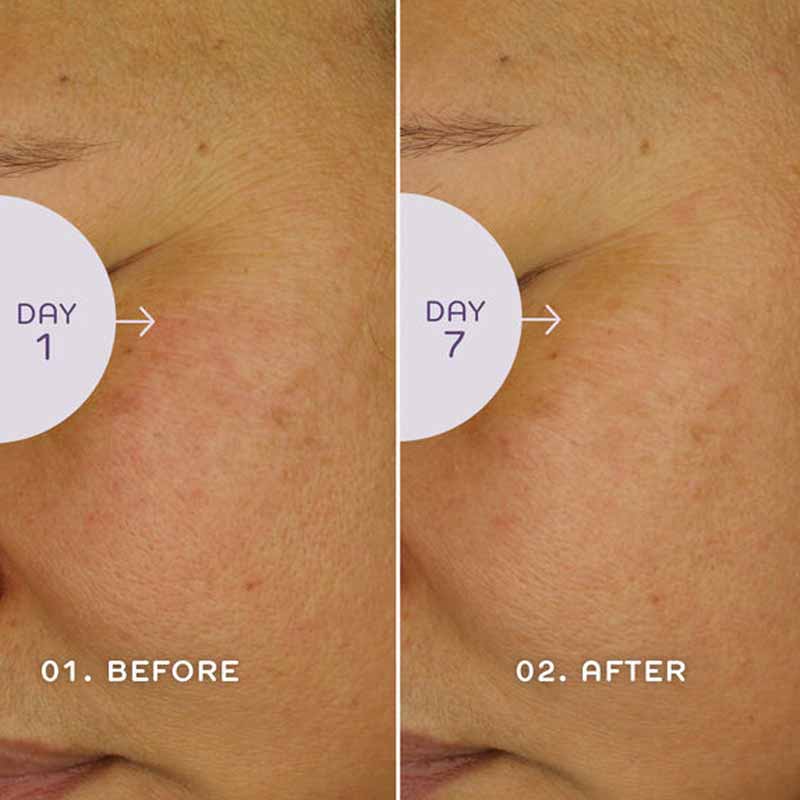 REN Bio Retinoid™ Youth Serum