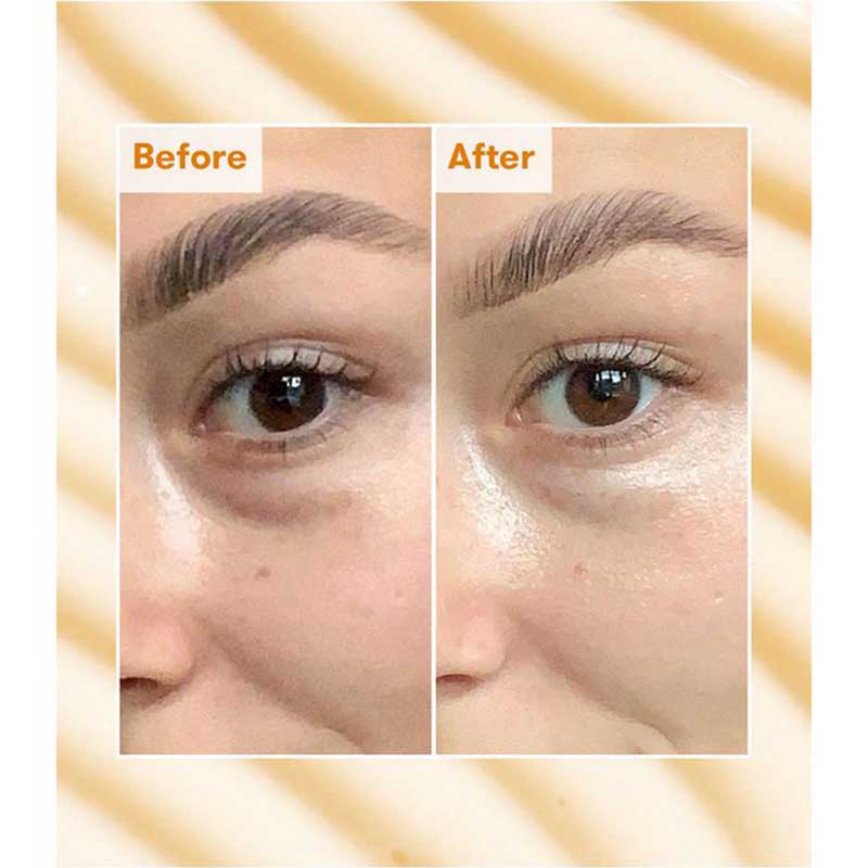 REN Radiance Brightening Dark Circle Eye Cream | skincare