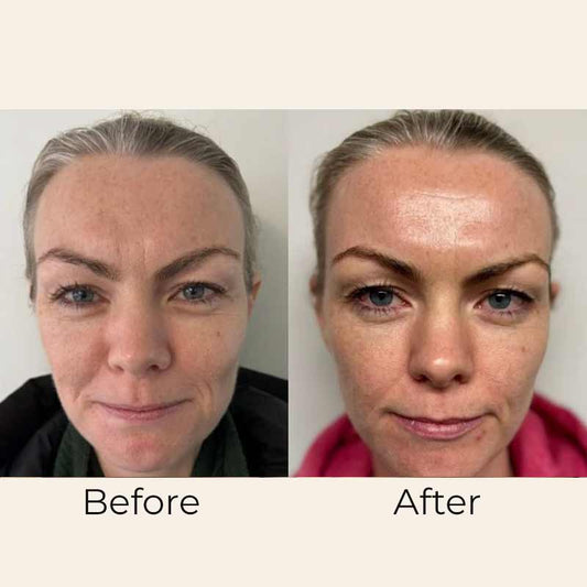 Skin Formulas, Skin Formulas Day Cream Moisturising SPF 50 Before & After, anti-ageing face cream