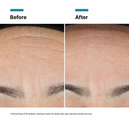 SkinCeuticals Advanced RGN-6 Before & After