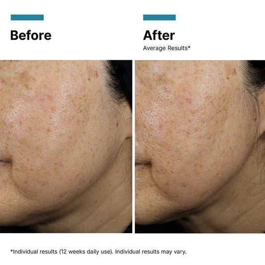 SkinCeuticals A.G.E. Interrupter Ultra Serum Results