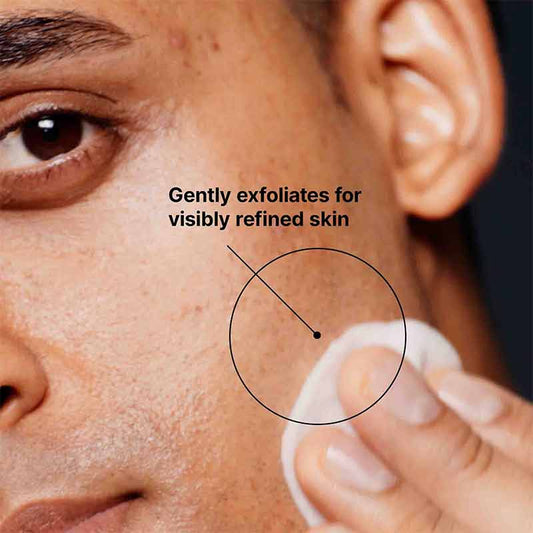 SkinCeuticals Blemish + Age Toner