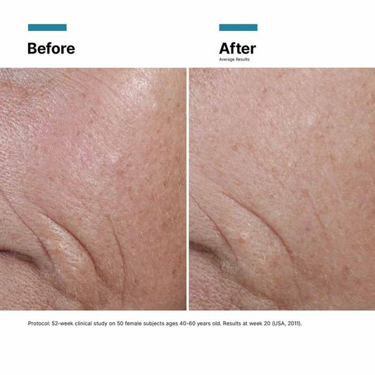 SkinCeuticals C E Ferulic with 15% L-Ascorbic Acid Results Before & After