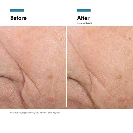 SkinCeuticals Triple Lipid Restore 2:4:2 Before & After