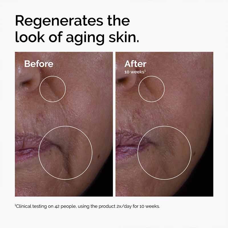 The Ordinary GF 15% Solution, serum for ageing skin, wrinkles, fine lines, crows feet
