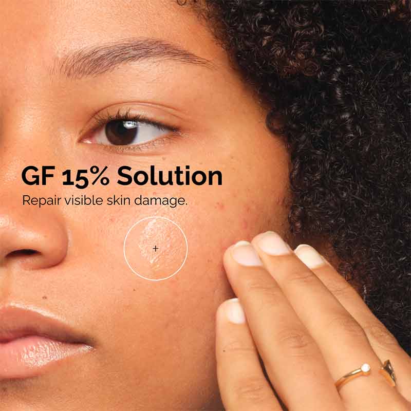 The Ordinary GF 15% Solution, skin damage repair, The Ordinary serum for ageing skin