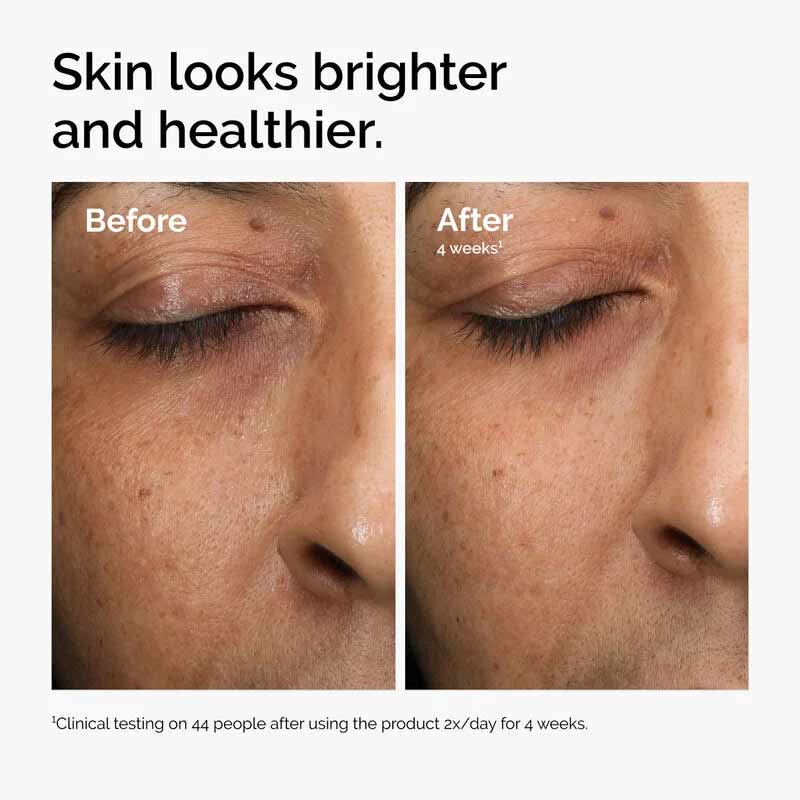 The Ordinary, The Ordinary Multi-Antioxidant Radiance Serum, Before and after radiance serum, dull skin