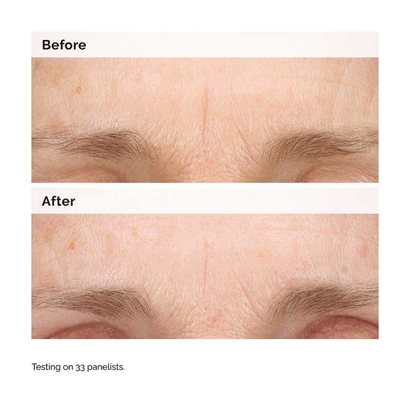The Ordinary Retinal 0.2% Emulsion  | Targets dark spots | Refines skin texture