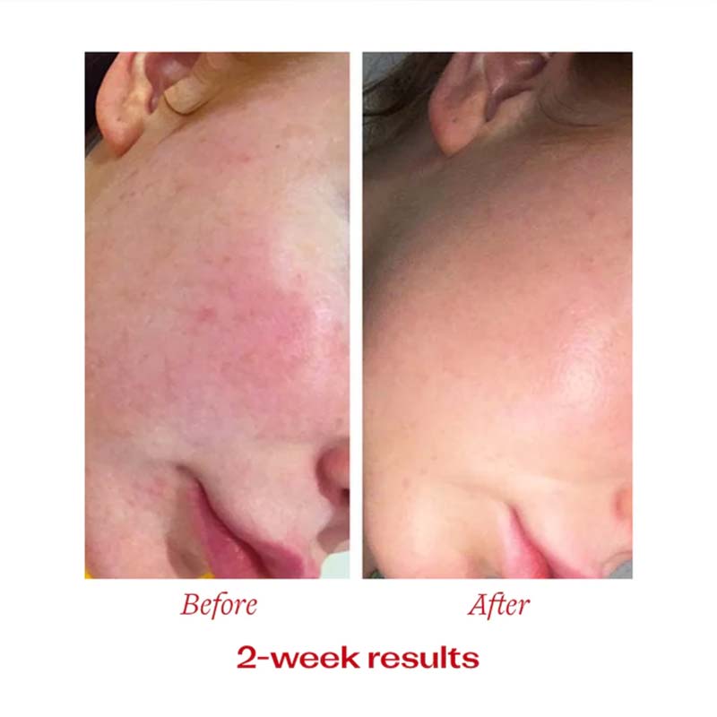 Trilogy Vitamin C Booster Treatment | Trilogy | Skincare | Face oil | treatment | vitamin C