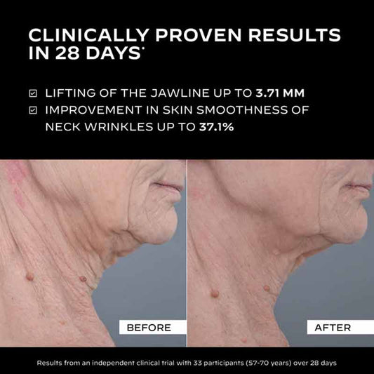 Zelens Collagen Solution Firming Serum Before & After