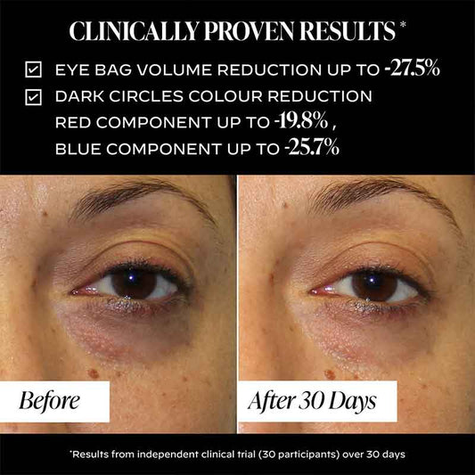 Zelens Triple-Action Eye Cream Before & After