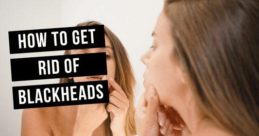 How to Get Rid of Blackheads Without Destroying Your Skin Barrier